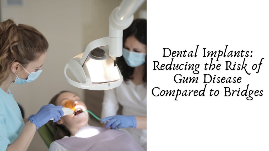 Dental Implants: Reducing the Risk of Gum Disease Compared to Bridges