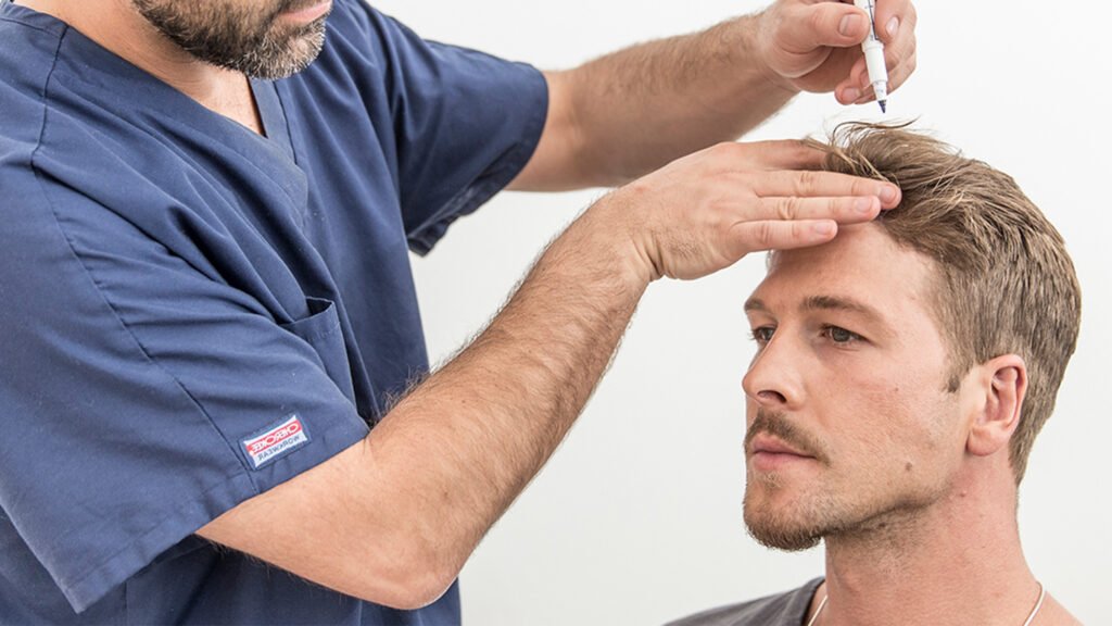 Understanding Hair Transplant Costs