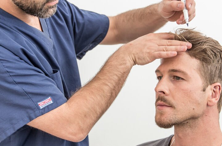 Understanding Hair Transplant Costs