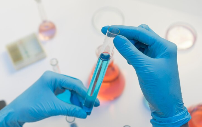 Peripheral Blood Smear Test