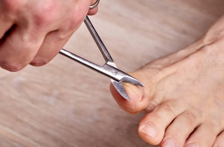 Best Long Handled Toenail Clippers for Elderly
