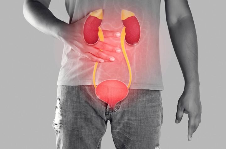 What Is The Treatment For Urinary Infections In Men?