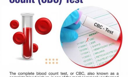 What is a CBC Test? A Comprehensive Guide