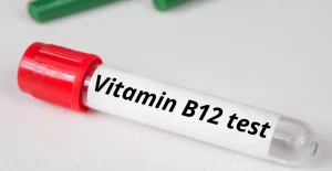 vitamin b12 test