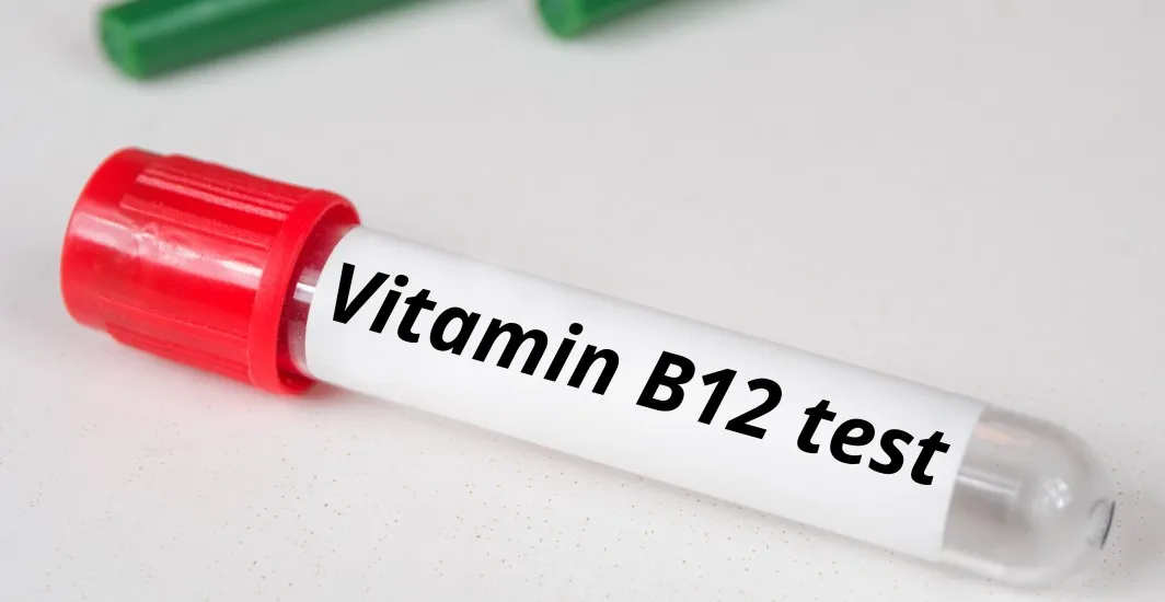 Why Get a Vitamin B12 Test This Winter