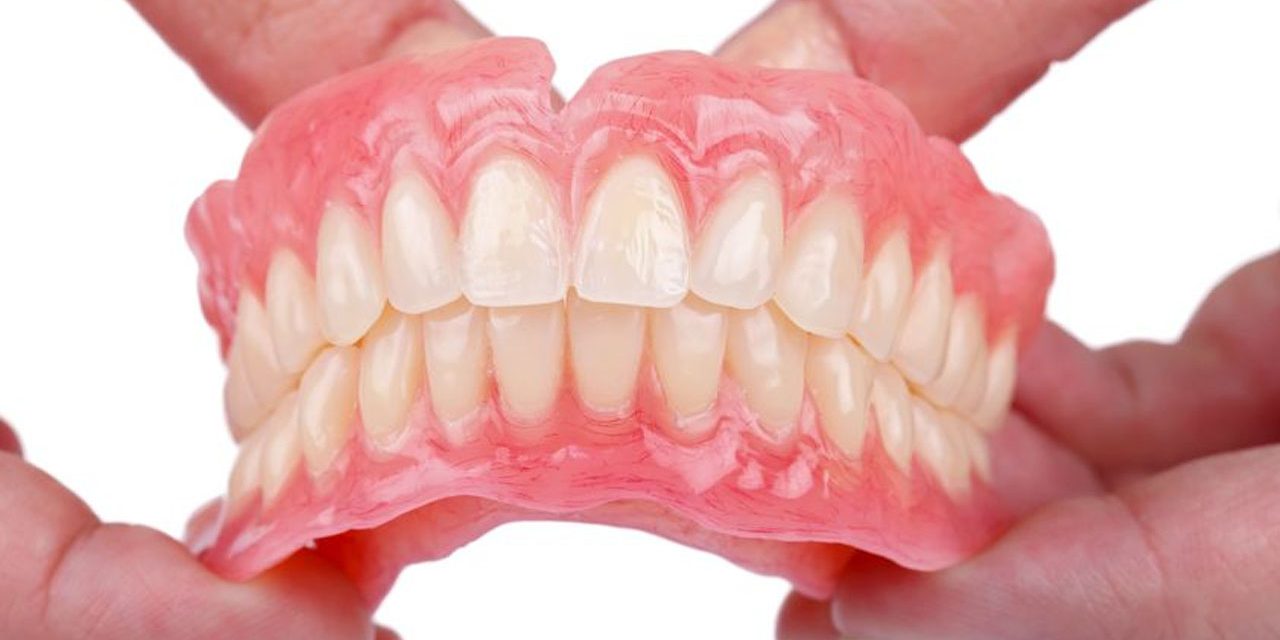 Dental Implants Reducing the Risk of Gum Disease Compared to Bridges