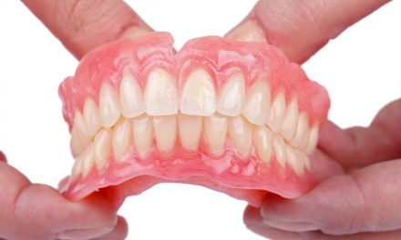 Dental Implants Reducing the Risk of Gum Disease Compared to Bridges