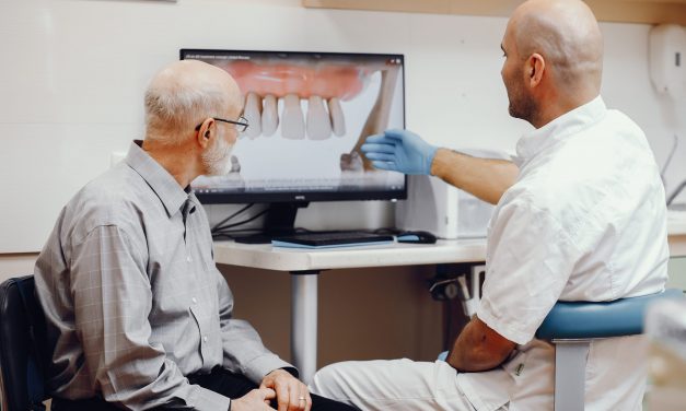 5 Common Myths About Dental Implants