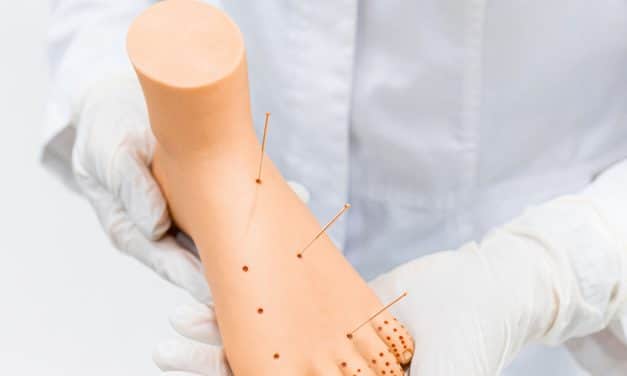 Pregabalin and It Effectiveness on Nerve Pain