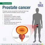 Prostate Cancer: Symptoms, Treatment and Tips