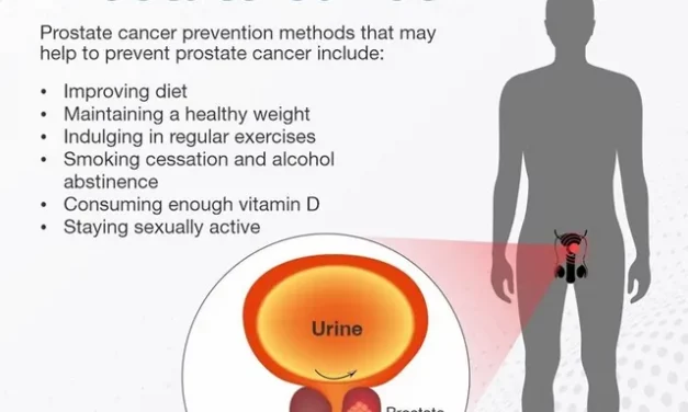 Prostate Cancer: Symptoms, Treatment and Tips