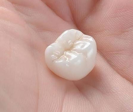 Porcelain Crowns: Step-by-Step What to Expect