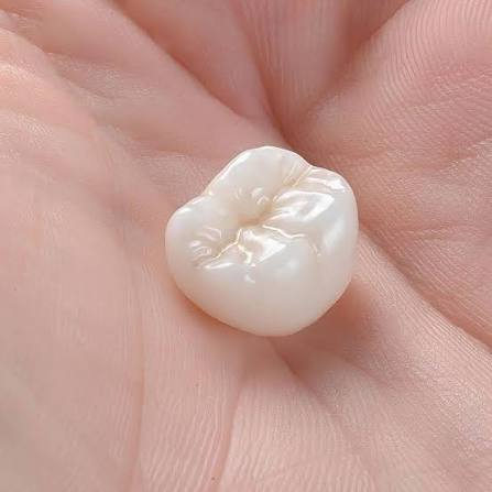 Porcelain Crowns: Step-by-Step What to Expect